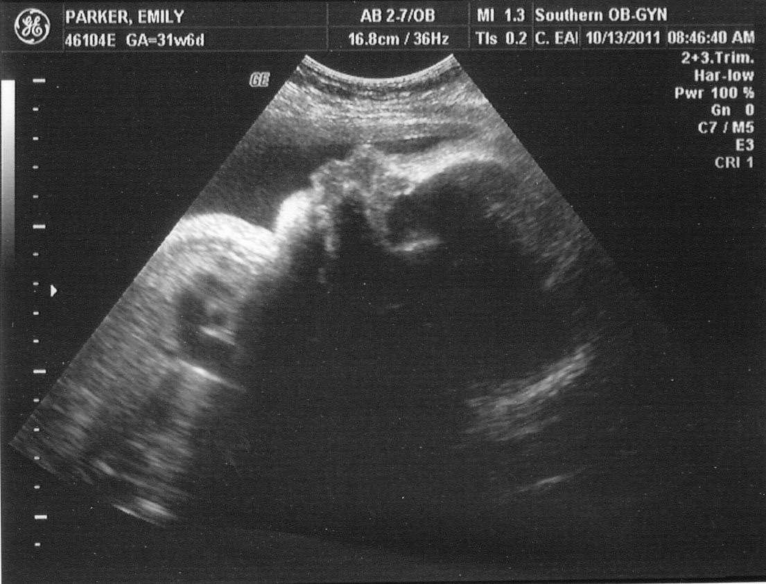 32 Week OBGYN Visit ~ Last Ultrasound!