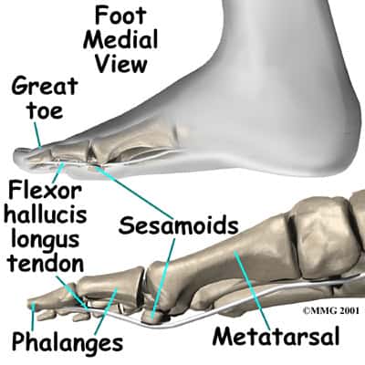 Fibular Sesamoidectomy