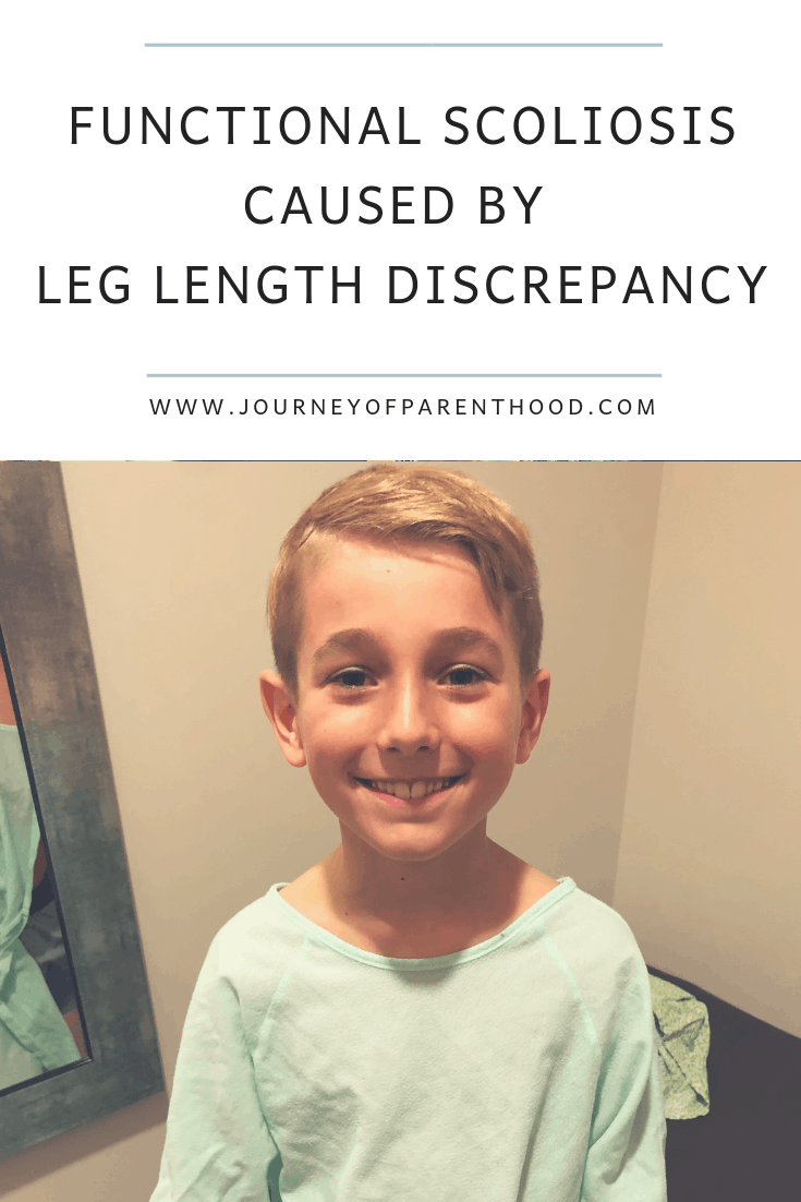 functional scoliosis caused by leg length discrepancy