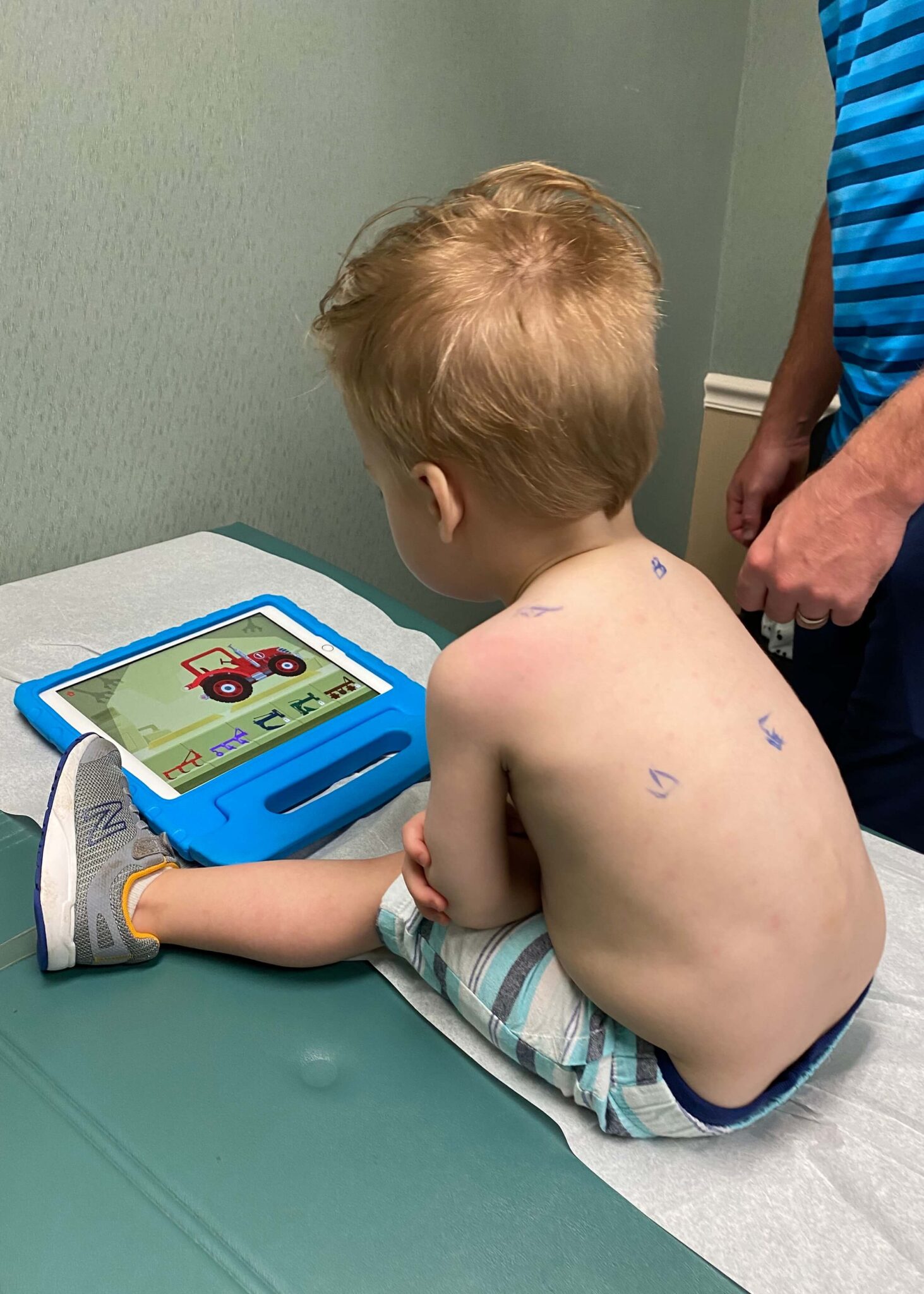 Allergy Testing for Toddler Spear's Experience with Allergies