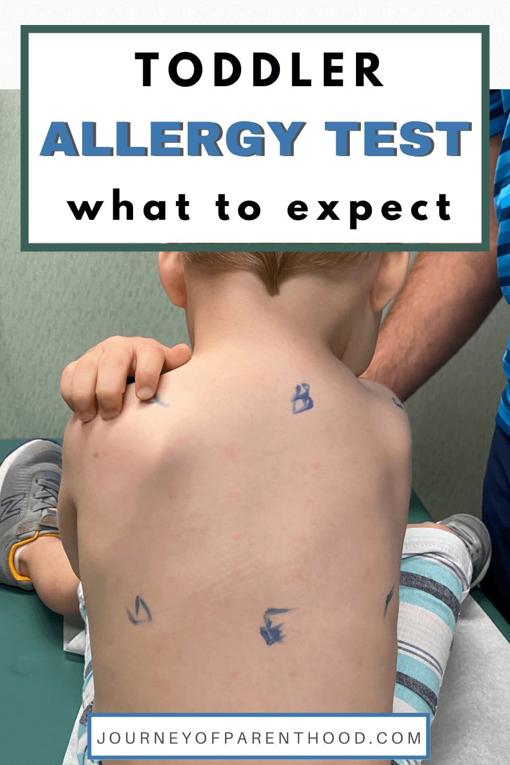 allergy testing for toddler