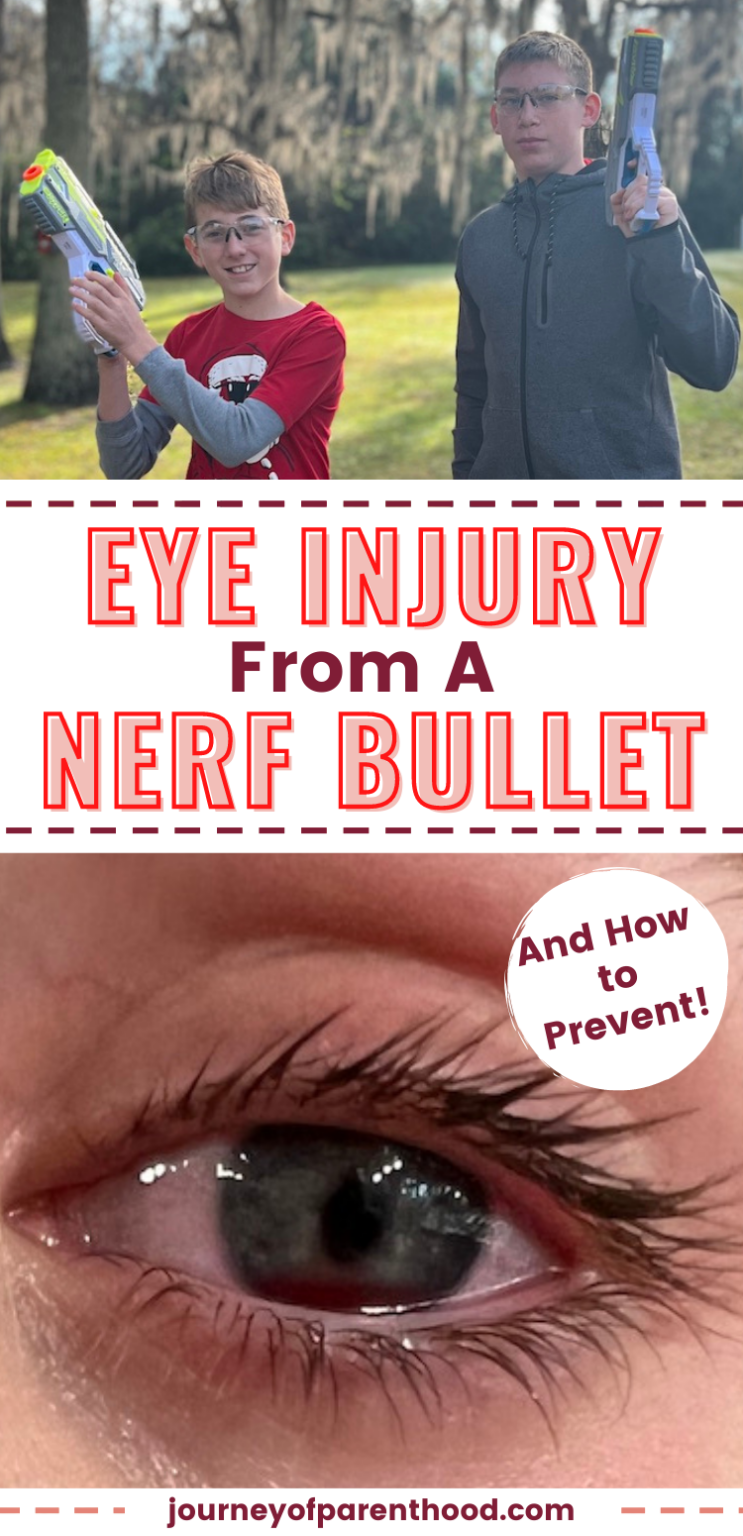 Nerf Gun Eye Injury Child Shot in Eye with Nerf Gun? What to Do!