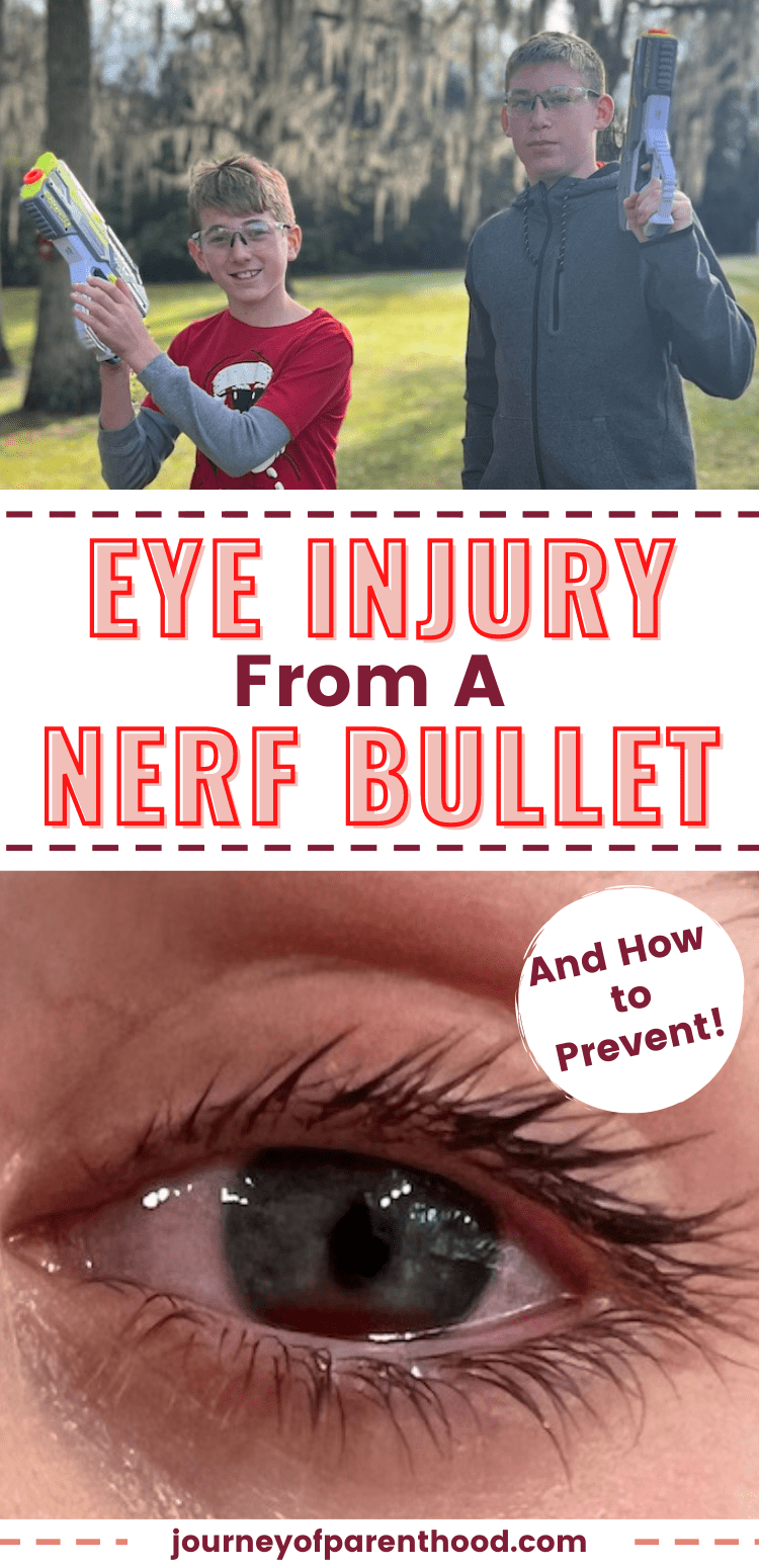 Nerf Gun Eye Injury: What to Do When Your Child Has Been Hit in the Eye with a Nerf Dart Bullet and How to Prevent Toy Gun Injuries