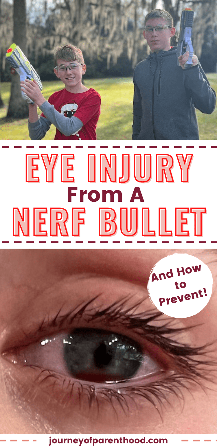 Doctors warn Nerf guns can cause irrerversible eye damage